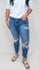 The Shanon Mid Rise Crop Skinny Denim Jeans - Mica *