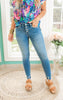 4 BUTTON SKINNY DENIM