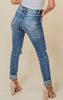 Distressed Mid Rise Cuffed hem Denim Skinny Jeans